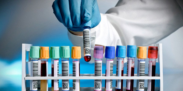 toxicological-test